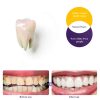 Dumie Instant Color-Correct Teeth Whitening Powder with Nano-2