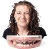 Premium Silicone Denture Reline Kit - Custom Comfort Fit, Long-Lasting-2