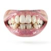 Dumie Instant Color-Correct Teeth Whitening Powder with Nano-6