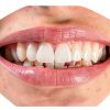 Dumie Instant Color-Correct Teeth Whitening Powder with Nano-3
