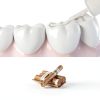 Tooth Paint Skymore Instant Teeth Whitening – Long‑Lasting Safe Gentle-4