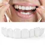 Adjustable Smile Support 2 Pairs Upper & Lower Braces by YYYker-0