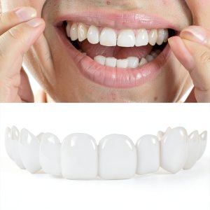Adjustable Smile Support 2 Pairs Upper & Lower Braces by YYYker-0