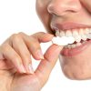 Adjustable Smile Support 2 Pairs Upper & Lower Braces by YYYker-1