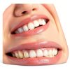 Adjustable Smile Support 2 Pairs Upper & Lower Braces by YYYker-2